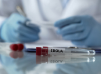 WHO: "Penyebaran Ebola saat ini melampaui upaya penahanan"