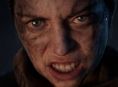 Senua's Saga: Hellblade II tampaknya akhirnya mendapatkan rilis fisik